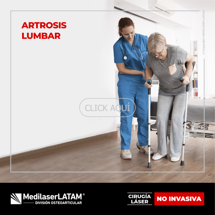 Artrosis de columna: Tratamiento láser que frena el deterioro y alivia el dolor sin cirugía. Postula para evaluación. ¡Resultados en semanas!
