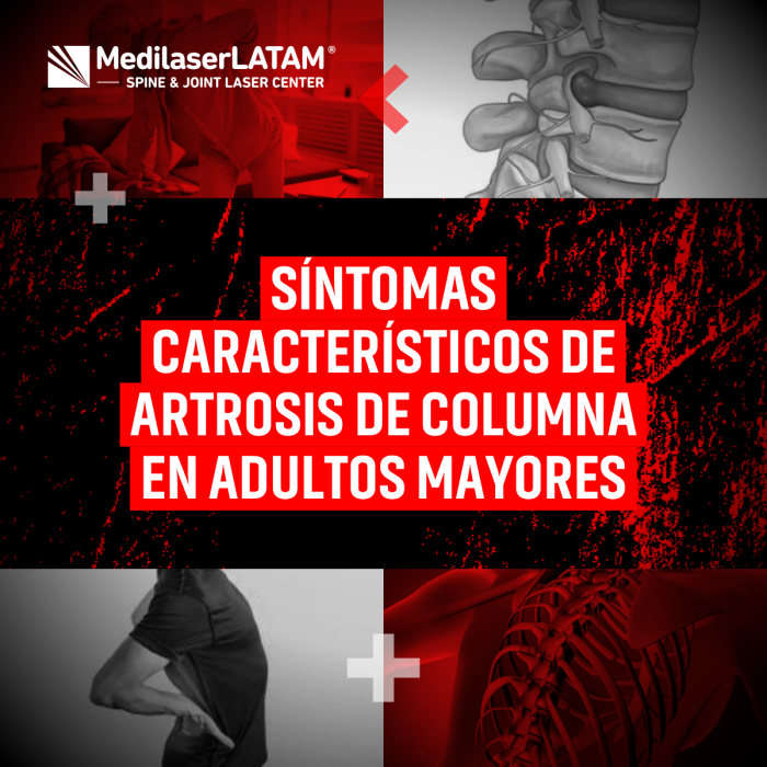 Artrosis de columna en mayores: rigidez, dolor nocturno y más. Aprende a identificarla y tratamientos para mejorar calidad de vida.