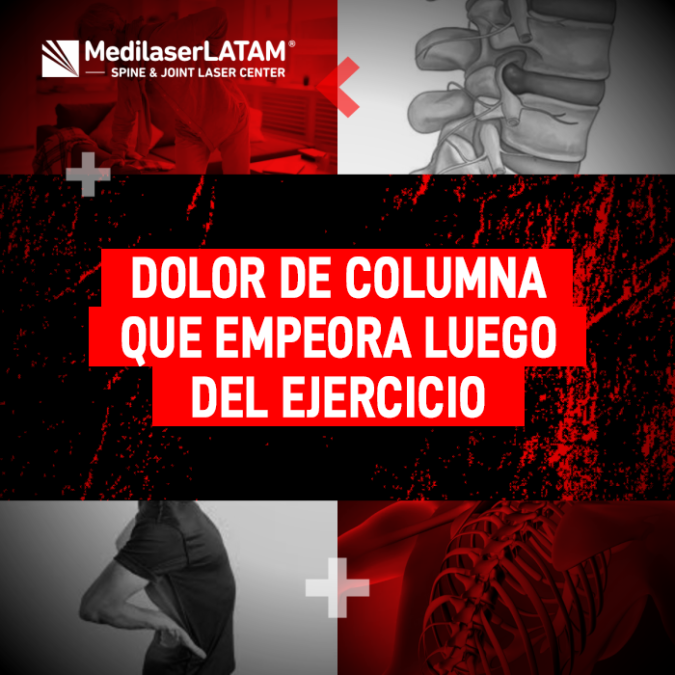 Dolor columna ejercicio: ¿Tu dolor empeora después de ejercitarte? Es una señal de inestabilidad y hernia. El Dr. Rojas explica cómo la cirugía láser la trata.