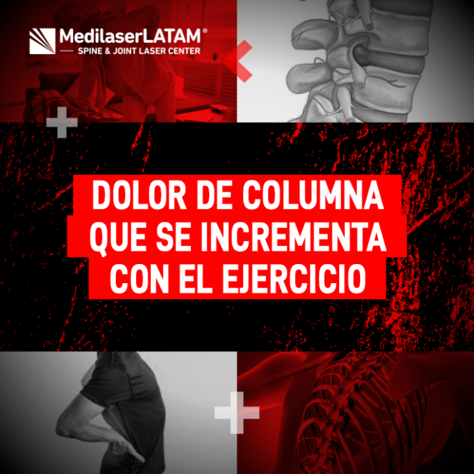 Dolor columna ejercicio: El Dr. Rojas explica por qué el dolor empeora con la actividad. Conoce esta señal de inestabilidad y cómo la cirugía láser ayuda.