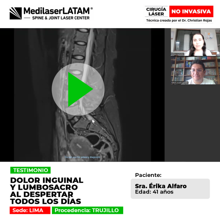Dolor inguinal y lumbosacro recurrente. Descubre cómo eliminar la artrosis y hernias de columna con tecnología láser avanzada sin cirugía.