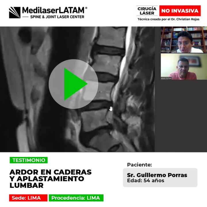 Ardor en Caderas y Aplastamiento Lumbar: descubre cómo liberar tus vértebras y eliminar el dolor crónico con nuestra tecnología láser.