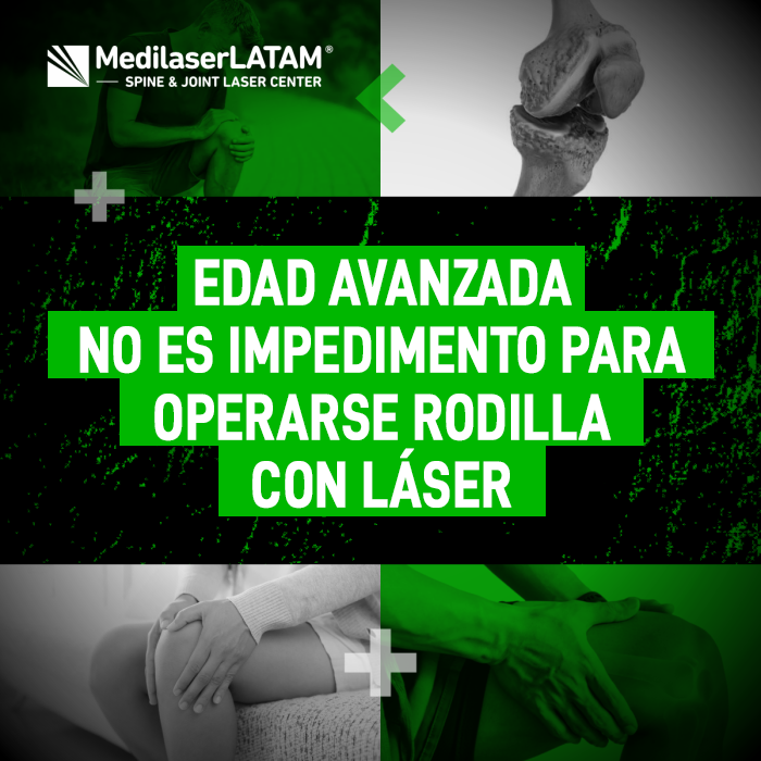 La edad no limita la posibilidad de tratar el desgaste de rodilla. Conoce cómo el procedimiento láser permite una recuperación segura en adultos mayores.