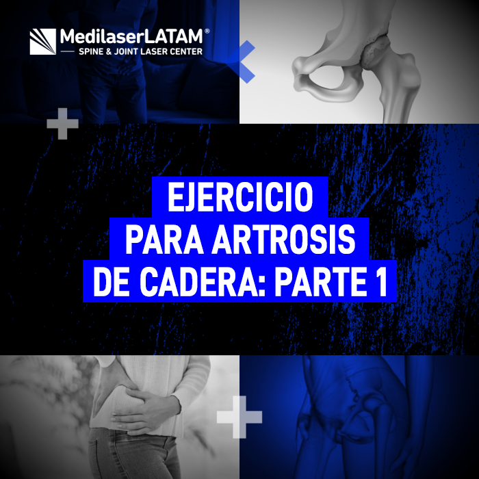 Artrosis de cadera: ejercicios clave para estabilizar la articulación. Recupere su movilidad y reduzca el dolor de forma segura y eficaz.
