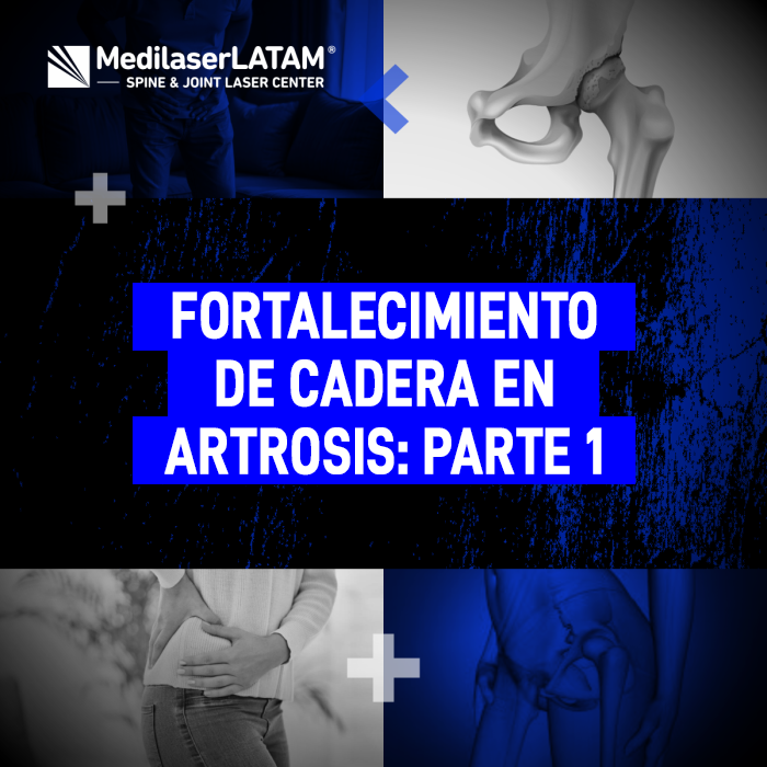 Guía de ejercicios para el fortalecimiento de cadera en casos de artrosis. Mejora tu movilidad y protege la articulación con estos consejos médicos.