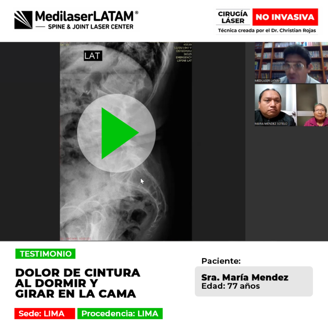 Dolor de cintura al dormir y girar en la cama. Recupere su descanso con nuestra cirugía láser no invasiva y evite el dolor crónico.