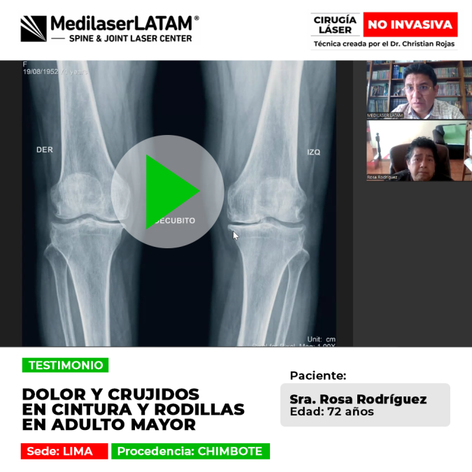 Recuperación de dolor y crujidos articulares en paciente adulto mayor. Descubre una solución efectiva para el desgaste de rodillas y cintura.