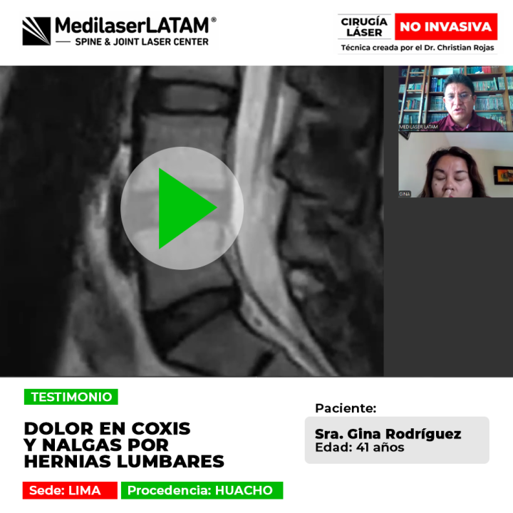 Testimonio sobre la eliminación del dolor en coxis y zona glútea causado por hernias lumbares. Descubre cómo el tratamiento láser evitó la cirugía.
