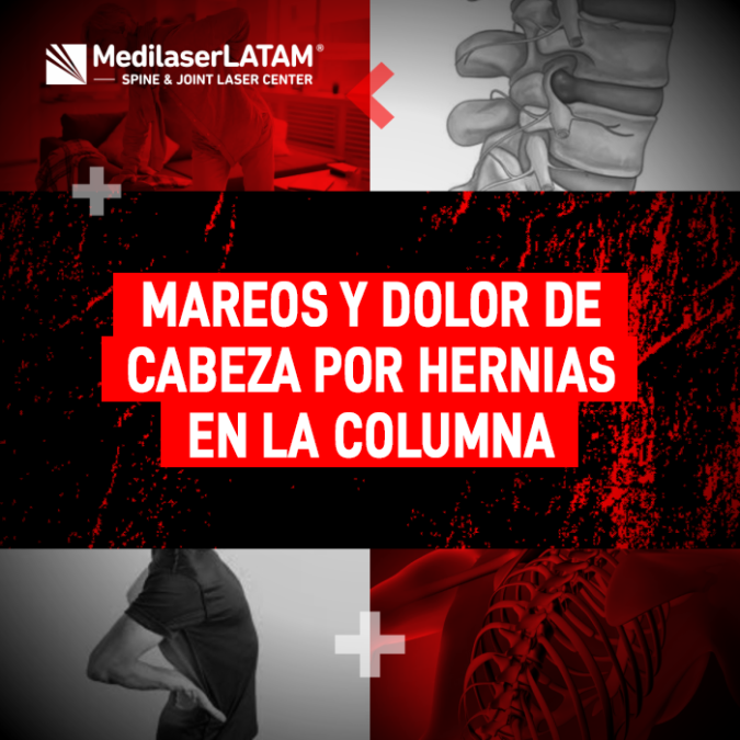 Mareos y dolor de cabeza causados por Hernias en la columna: análisis de síntomas y opciones de recuperación con tecnología láser.