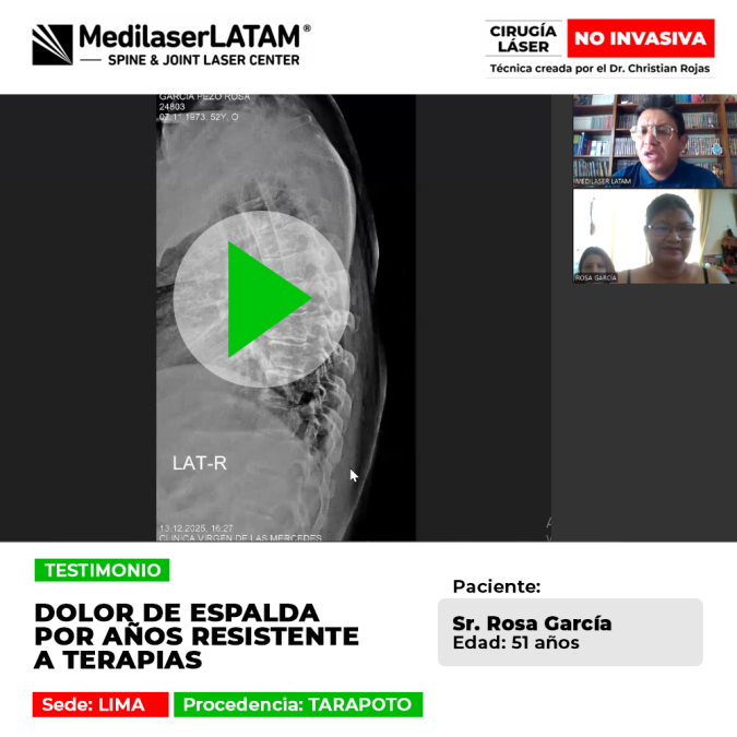 Dolor de espalda por años resistente a terapias. Descubre la recuperación de este paciente con tecnología láser avanzada en nuestro blog.