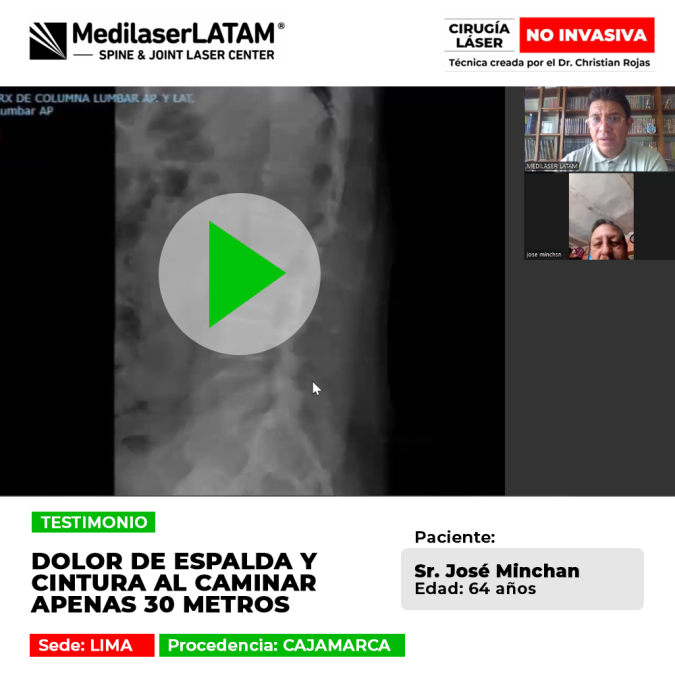 Dolor de espalda crónico que limita tu marcha. Conoce este caso clínico resuelto mediante tratamiento láser ambulatorio en Medilaser LATAM.