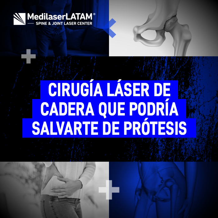 Descubre cómo la tecnología médica avanzada permite tratar el desgaste de cadera a tiempo, evitando intervenciones quirúrgicas mayores.