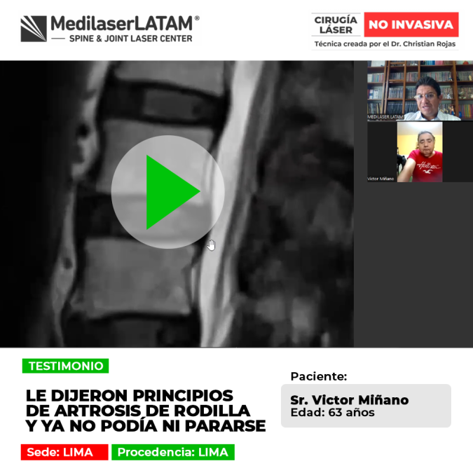 La artrosis de rodilla en fases avanzadas imposibilita ponerse de pie. Infórmate sobre soluciones oportunas para recuperar la marcha.