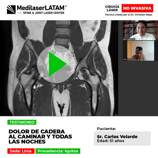 El dolor de cadera constante perjudica el andar y arruina el descanso nocturno. Conoce tratamientos especializados para superarlo.