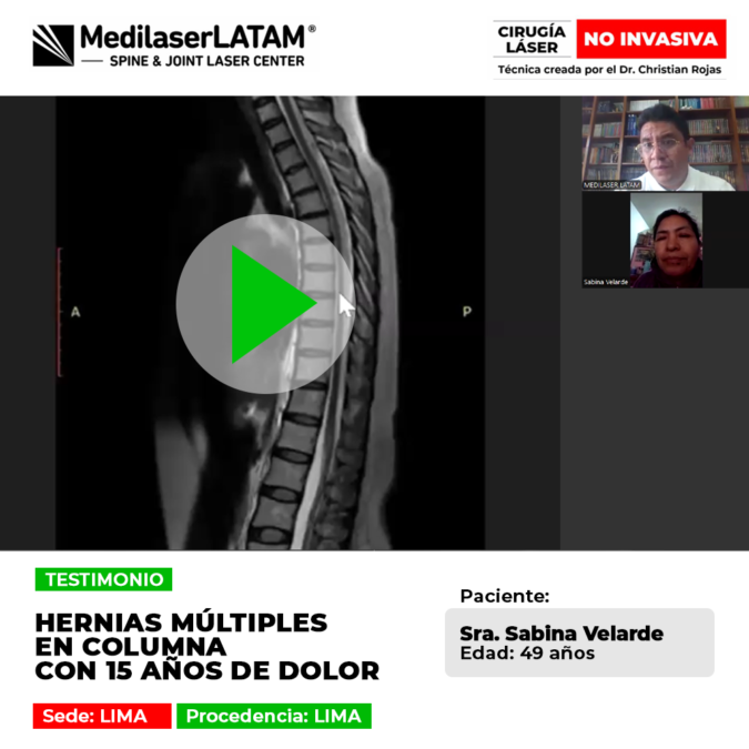 Las hernias múltiples en la columna vertebral generan dolores crónicos de larga duración. Infórmate sobre alternativas de mejoría.